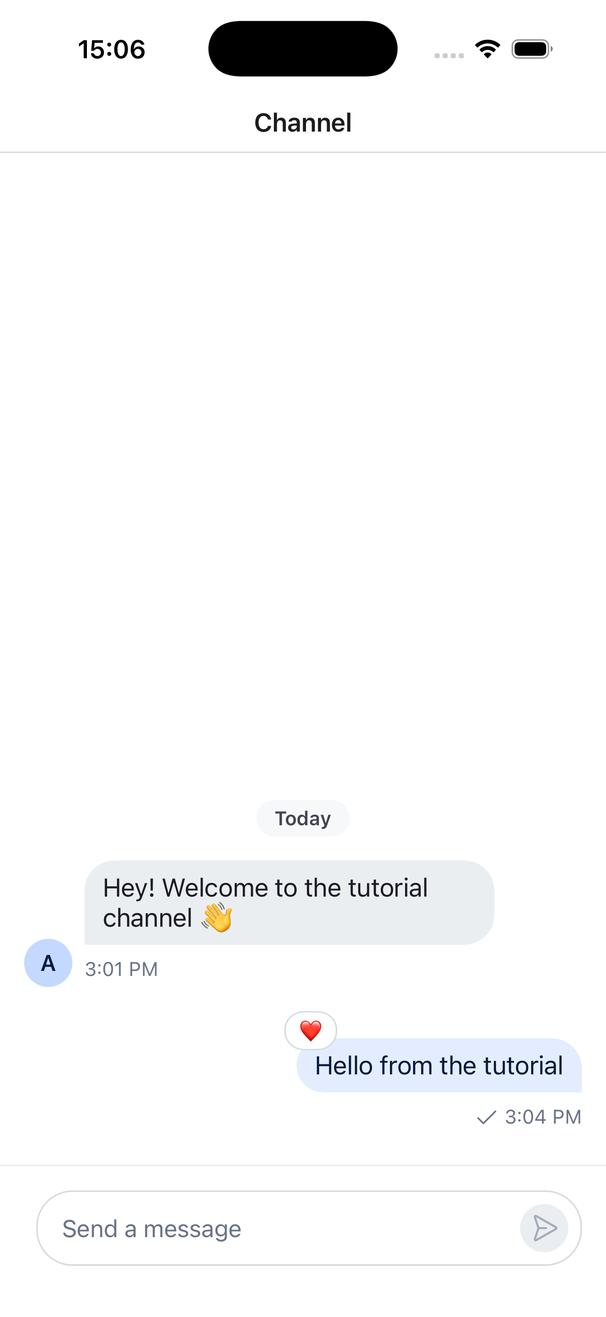 Channel screen on iOS